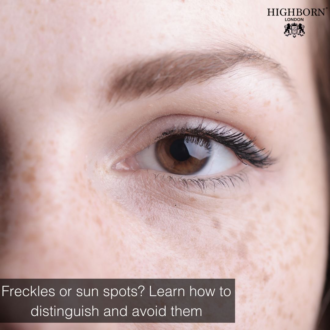 Freckles or sun spots? Learn how to distinguish and avoid them