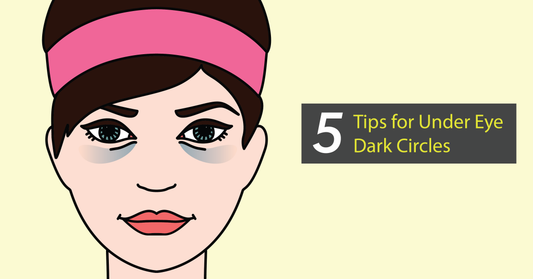 Tips for Under Eye Dark Circles