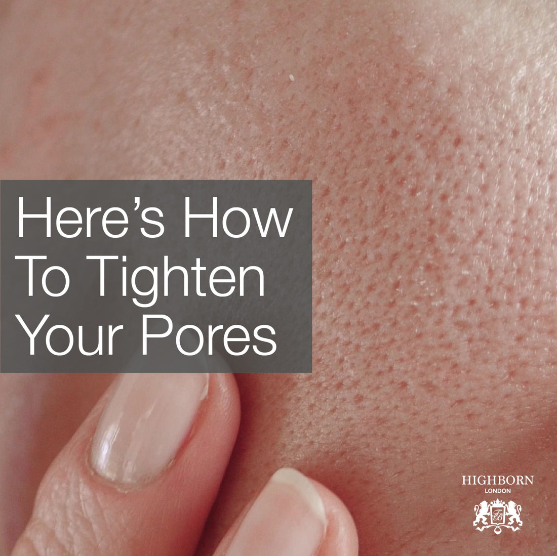 10 Important Lessons For Dealing With Enlarged Pores